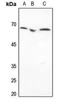 1 - Anti-Histone Deacetylase 1 Antibody [KO/KD Validated] AP95410