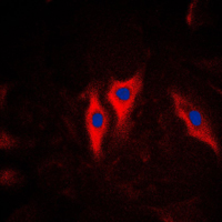 3 - Anti-Cytokeratin 5 Antibody AP95412