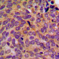 19 - Anti-Cytokeratin 5 Antibody AP95412
