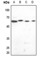 1 - Anti-Cytokeratin 5 Antibody AP95412