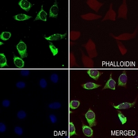 3 - Anti-Beta-2 Adrenergic Receptor Antibody AP95414