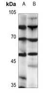 1 - Anti-Beta-2 Adrenergic Receptor Antibody AP95414