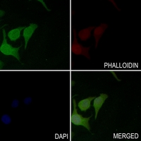 3 - Anti-BCL2 (Phospho-S70) Antibody AP95415