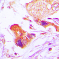 19 - Anti-BCL2 (Phospho-S70) Antibody AP95415