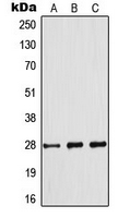 1 - Anti-BCL2 (Phospho-S70) Antibody AP95415