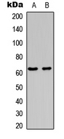 1 - Anti-c-FOS (Phospho-S362) Antibody AP95416