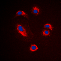 3 - Anti-MMP10 Antibody AP95417