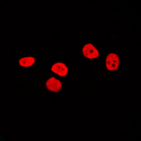 3 - Anti-SOX9 Antibody AP95419