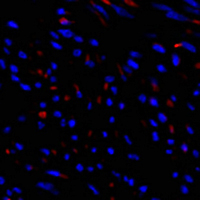 3 - Anti-TIMP1 Antibody AP95420