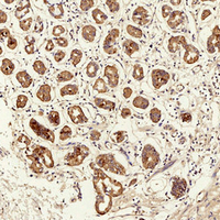 19 - Anti-TIMP1 Antibody AP95420