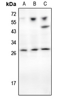 1 - Anti-TIMP1 Antibody AP95420