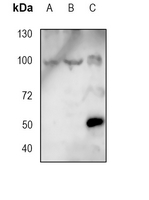 1 - Anti-CD19 Antibody AP95485