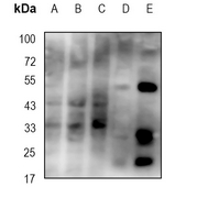 1 - Anti-CD25 Antibody AP95493