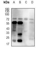 1 - Anti-CD122 Antibody AP95595
