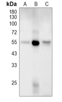 1 - Anti-CD274 Antibody AP95609