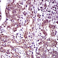19 - Anti-ABCG5 Antibody AP95640