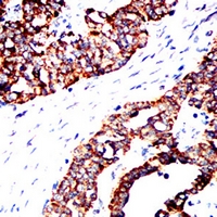 19 - Anti-ACAA1 Antibody AP95641