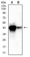 1 - Anti-ACAA1 Antibody AP95641