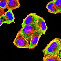 3 - Anti-ACADM Antibody AP95642