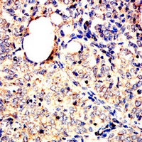 19 - Anti-ACADM Antibody AP95642