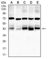 1 - Anti-ACADM Antibody AP95642