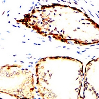 19 - Anti-Acetylcholinesterase Antibody AP95643