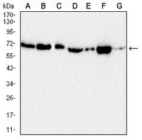 1 - Anti-Acetylcholinesterase Antibody AP95643