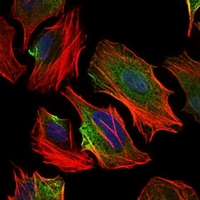 3 - Anti-ACLY Antibody AP95644