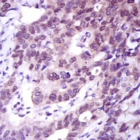 19 - Anti-ACLY Antibody AP95644