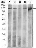 1 - Anti-ACLY Antibody AP95644