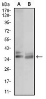 1 - Anti-ACP5 Antibody AP95645