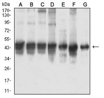 1 - Anti-Smooth Muscle Actin Antibody AP95646