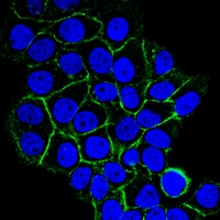 3 - Anti-CD156b Antibody AP95648