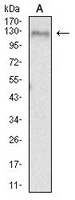 1 - Anti-CD156b Antibody AP95648