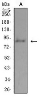 1 - Anti-ADAMTS1 Antibody AP95649