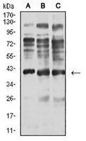 1 - Anti-Centaurin-alpha-1 Antibody AP95650