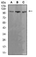 1 - Anti-ADAR1 Antibody AP95651