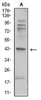1 - Anti-Beta-2 Adrenergic Receptor Antibody AP95652
