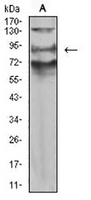 1 - Anti-XB130 Antibody AP95654