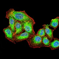 3 - Anti-AKT Antibody AP95655