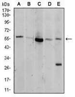 1 - Anti-AKT Antibody AP95655