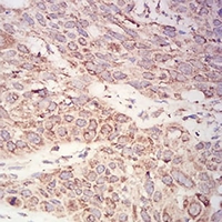 19 - Anti-AKT Antibody AP95656