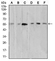 1 - Anti-AKT Antibody AP95656