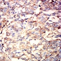 19 - Anti-ALB Antibody AP95657