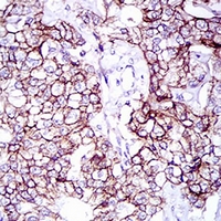 19 - Anti-CD166 Antibody AP95658