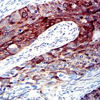 19 - Anti-ALDH1A1 Antibody AP95659