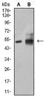 1 - Anti-ALDH1A1 Antibody AP95659