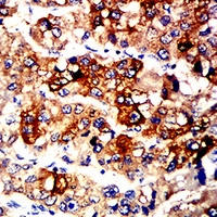 19 - Anti-ALDH1L1 Antibody AP95660