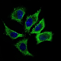 3 - Anti-ALDH2 Antibody AP95661