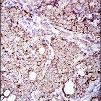 19 - Anti-ALDH2 Antibody AP95661